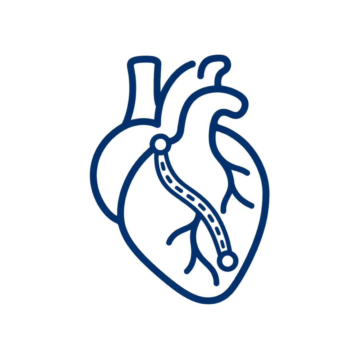 Heart Bypass Surgery